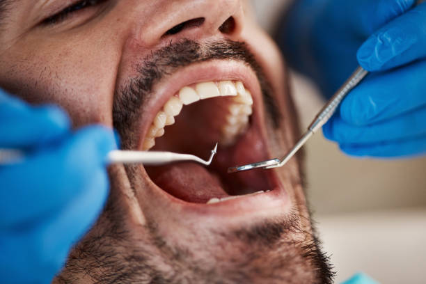 Best Cracked Tooth Emergency Dentist  in Kenneth City, FL